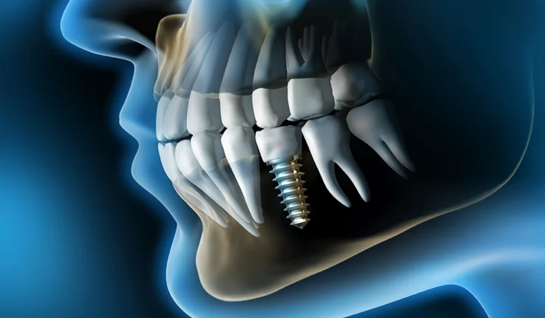 58bfcb6fda2f96a113fe2b6f5297ae9d