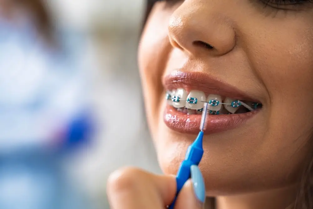 Why Neuromuscular Orthodontics Is the Future of Pain-Free Smiles